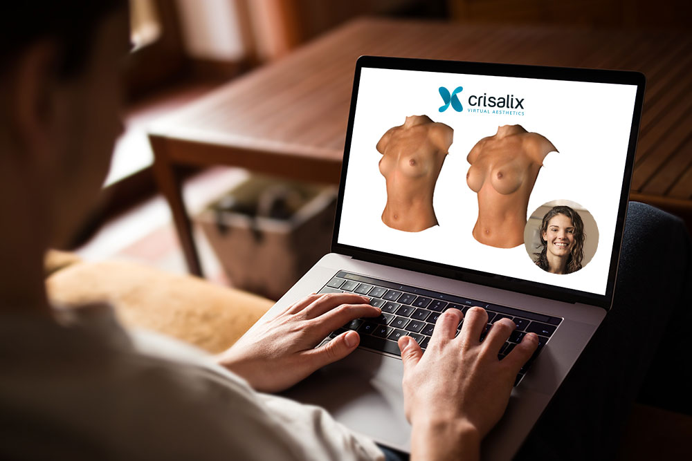 Online-Beratung mit Ihrem eigenen 3D-Bild